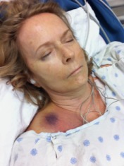2011-05-16-Janeen's TBI-14.jpg
